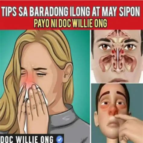 Tips Sa Baradong .